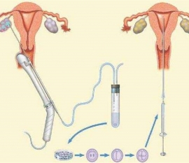 35岁女性备孕请做好以下检查，“健康宁波代生宝宝”跑不远